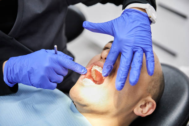 Best Chipped Tooth Repair Near Me  in Holden Heights, FL